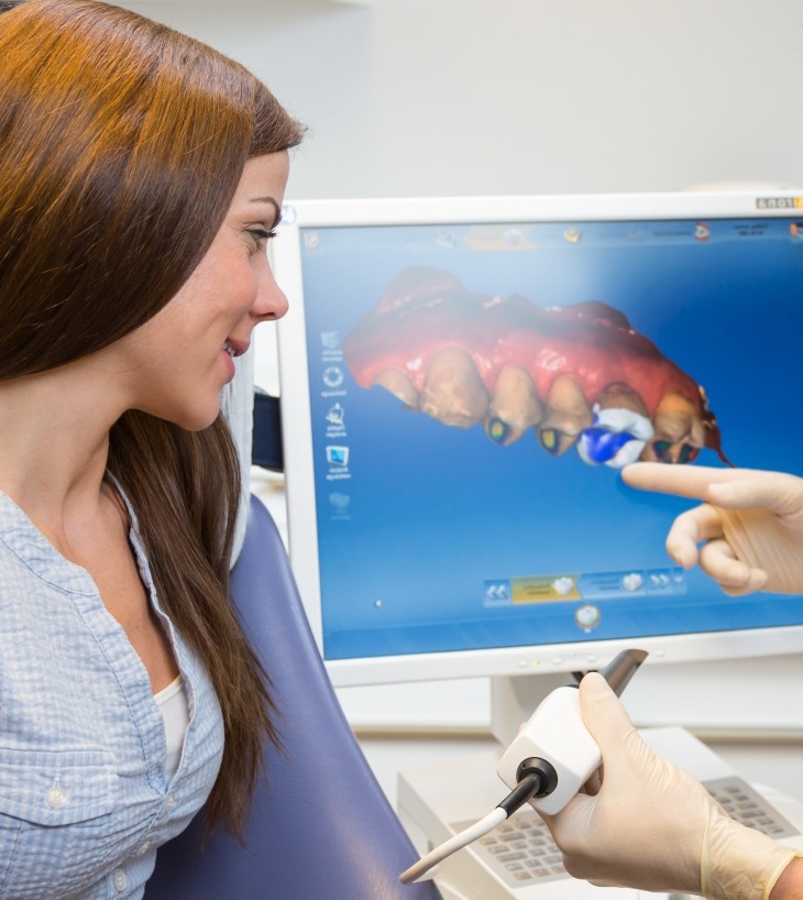 dentist pointing to dental impression