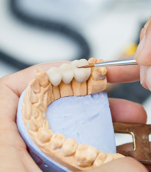 Dentist working on dental bridge