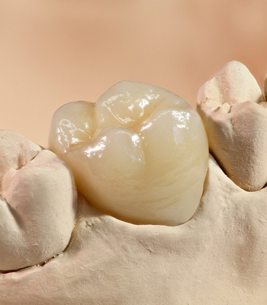 close up of dental crown mock up