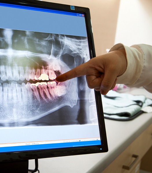 dentist pointing to red teeth on x-ray